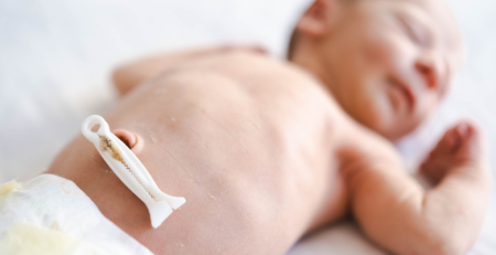 Biomarcador no cordão umbilical pode prever risco cardiometabólico nos bebés de mães com obesidade